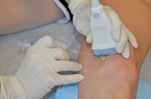descubre cómo la oxitropina se está utilizando en la medicina regenerativa para promover la reparación de tejidos y mejorar la regeneración celular. beneficios, aplicaciones y avances científicos recientes.