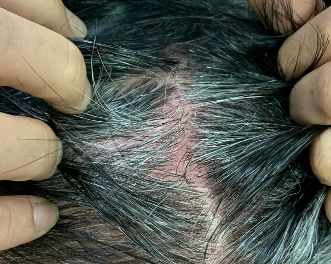 descubre los beneficios de la oxitropina para mejorar la salud de tu piel y cabello. aprende cómo este ingrediente puede fortalecer, hidratar y revitalizar tu belleza natural.